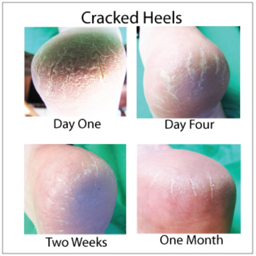 12 Jars of Great Scott Skin Cream - $150.00....Free Shipping INCLUDED.